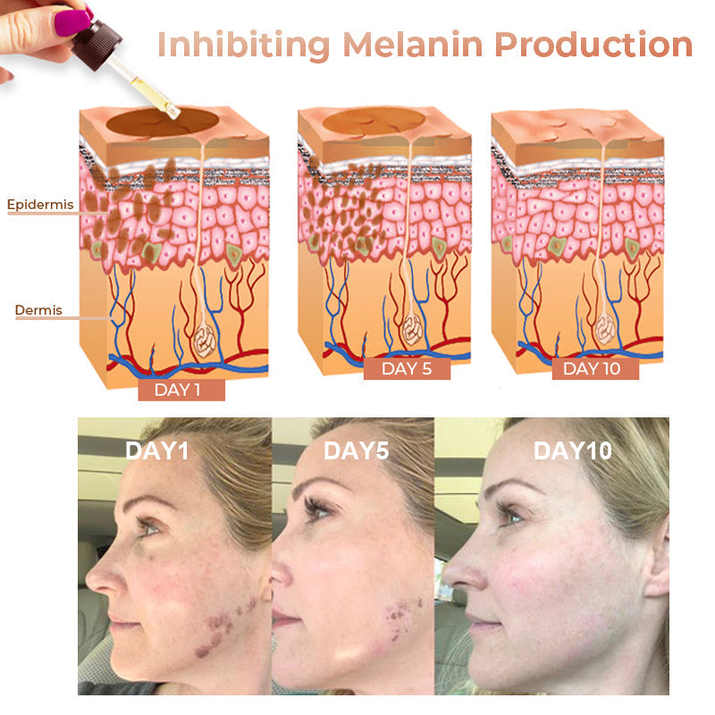Dobshow® Melanin Correcting Facial Serum with L-Ascorbic Acid- Erase Pigmentation in 2 weeks!