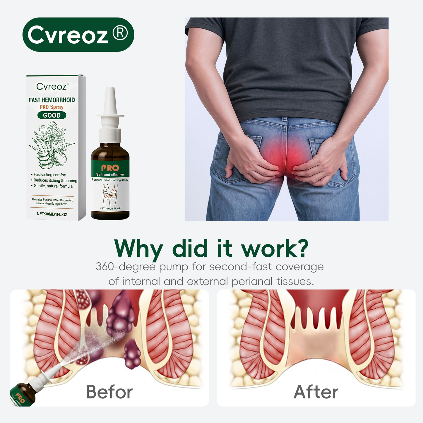 🎅𝘾𝙝𝙧𝙞𝙨𝙩𝙢𝙖𝙨 𝙎𝙖𝙡𝙚🎁 Cvreoz® Fast Hemorrhoid PRO Spray