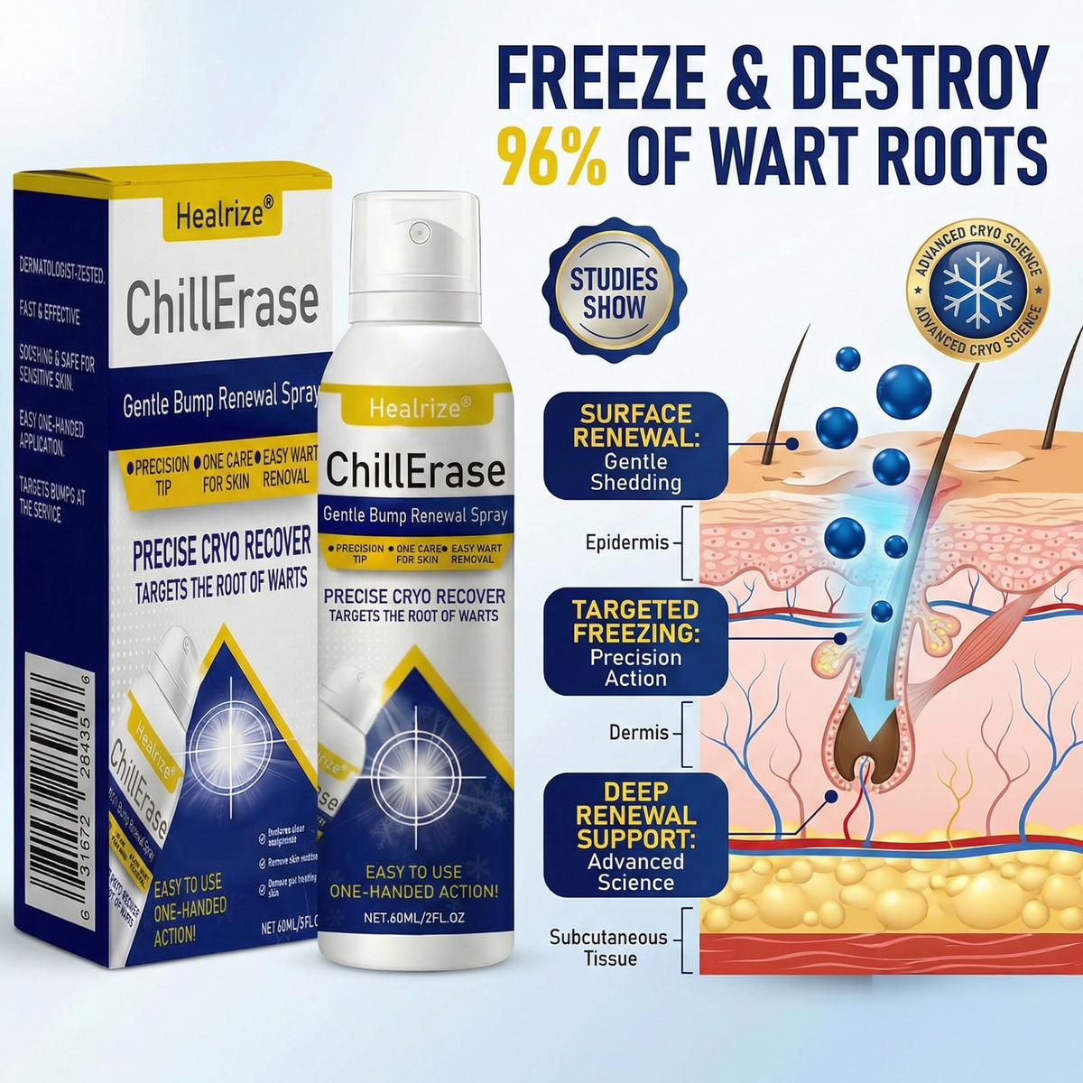 ❄️Healrize®ChillErase Gentle Bump Renewal Spray
