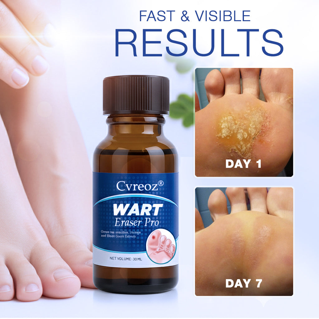 Cvreoz® Wart Eraser Pro