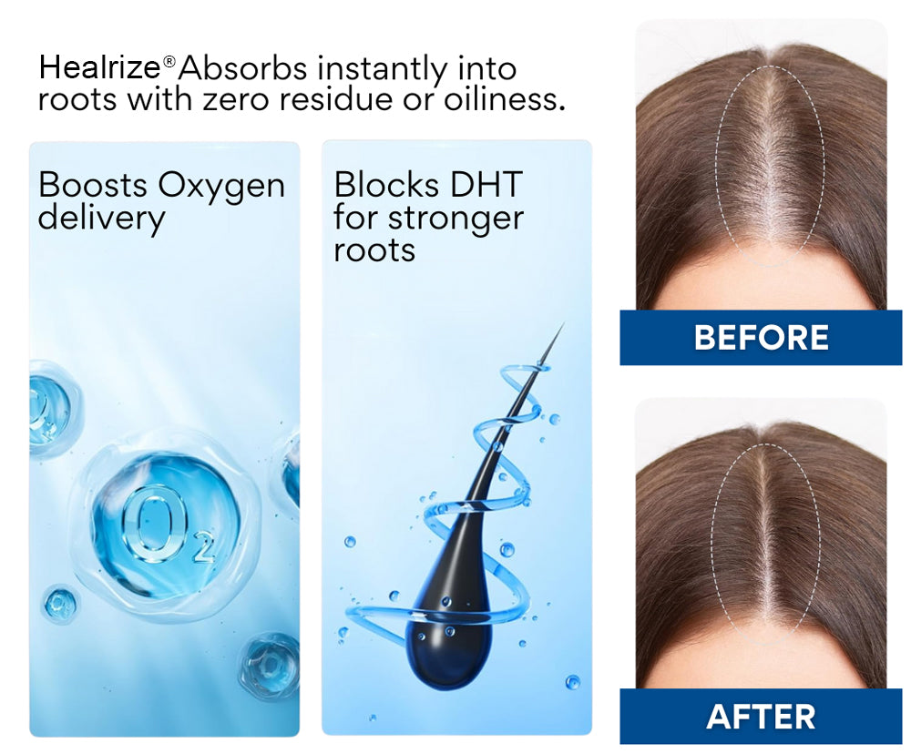 ✨𝙇𝙞𝙢𝙞𝙩𝙚𝙙-𝙏𝙞𝙢𝙚 𝙊𝙛𝙛𝙚𝙧   | Healrize®  NeuroRoot Reset Roll-On Serum