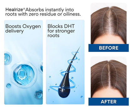 ✨𝙇𝙞𝙢𝙞𝙩𝙚𝙙-𝙏𝙞𝙢𝙚 𝙊𝙛𝙛𝙚𝙧   | Healrize®  NeuroRoot Reset Roll-On Serum