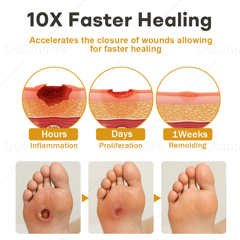 🔥𝙎𝙥𝙚𝙘𝙞𝙖𝙡 𝙋𝙧𝙤𝙢𝙤𝙩𝙞𝙤𝙣|  Healrize® GlucoShield Bee Venom Wound Spray🔥