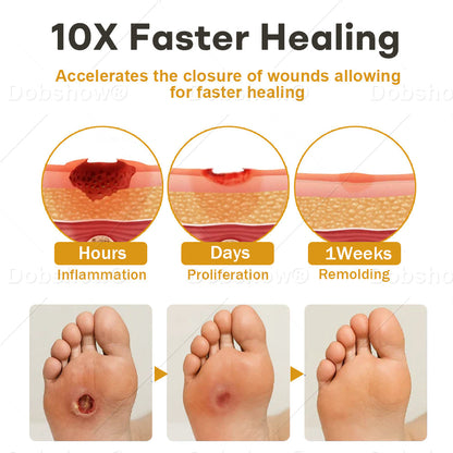 🔥𝙎𝙥𝙚𝙘𝙞𝙖𝙡 𝙋𝙧𝙤𝙢𝙤𝙩𝙞𝙤𝙣|  Healrize® GlucoShield Bee Venom Wound Spray🔥