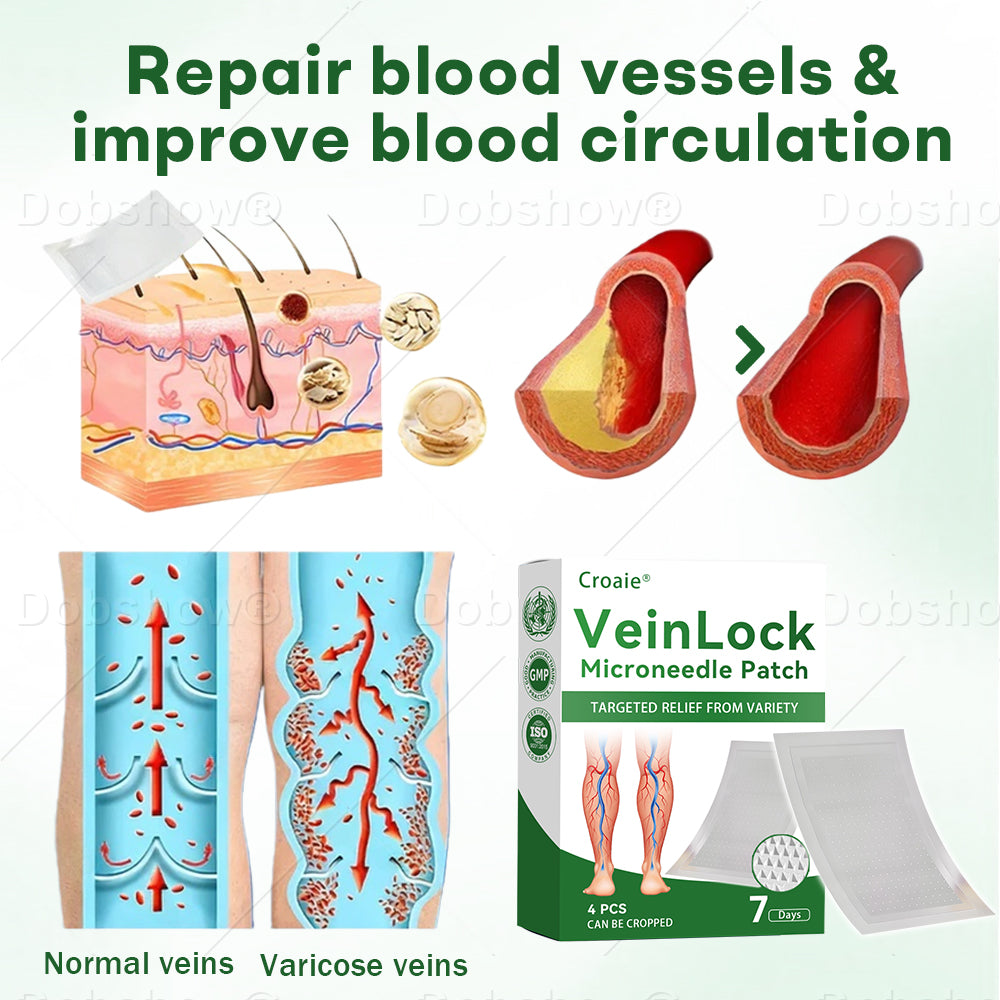 🎅 𝘾𝙝𝙧𝙞𝙨𝙩𝙢𝙖𝙨 𝙎𝙖𝙡𝙚 | Croaie® VeinLock Microneedle Patch