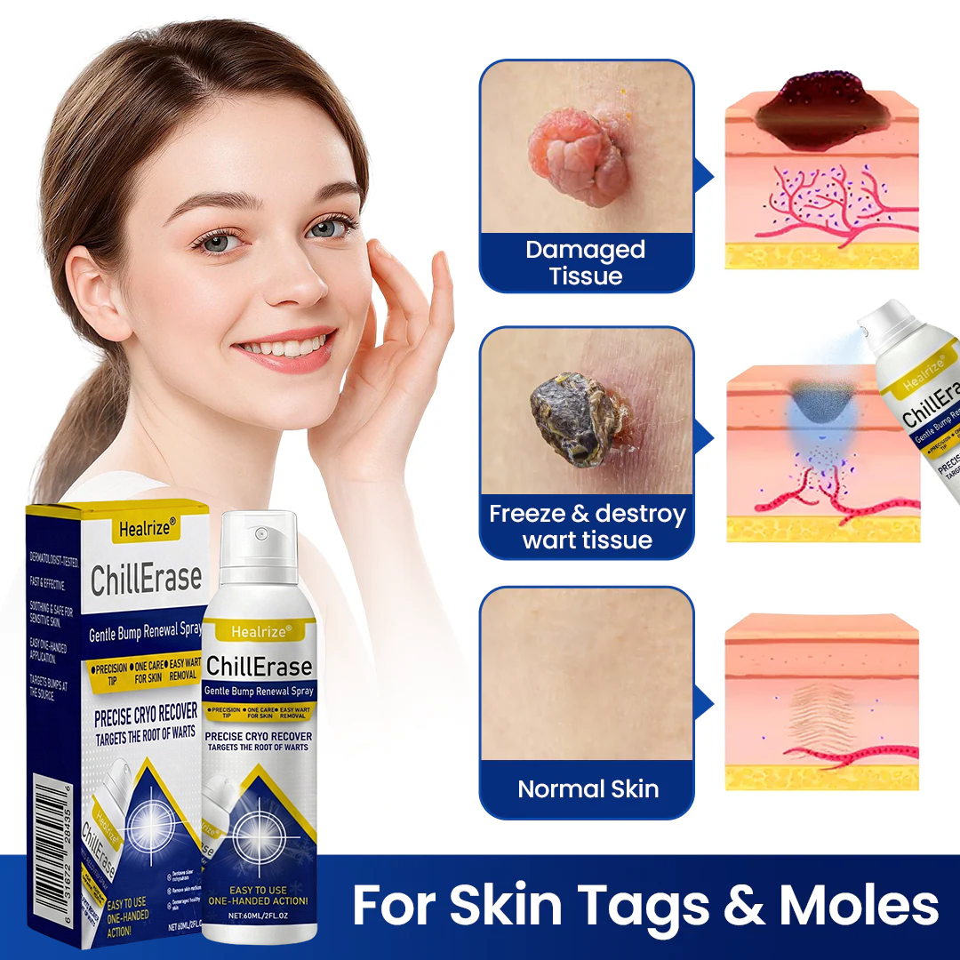 ❄️Healrize®ChillErase Gentle Bump Renewal Spray