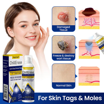 ❄️Healrize®ChillErase Gentle Bump Renewal Spray