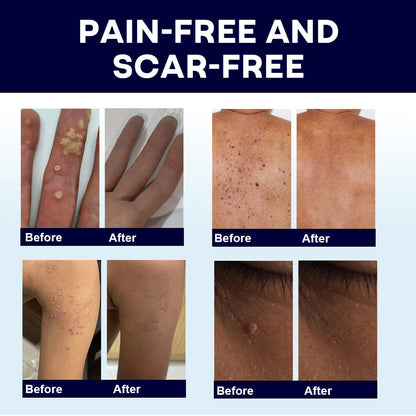 🖤🔥𝘽𝙡𝙖𝙘𝙠 𝙁𝙧𝙞𝙙𝙖𝙮 𝙨𝙖𝙡𝙚 | AAFQ® WartLock CRYO RECOVERY SPRAY