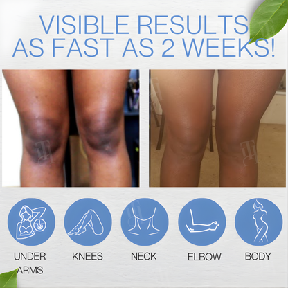 Healrize® Niacin-Retinol Dual-Action Brightening Cream