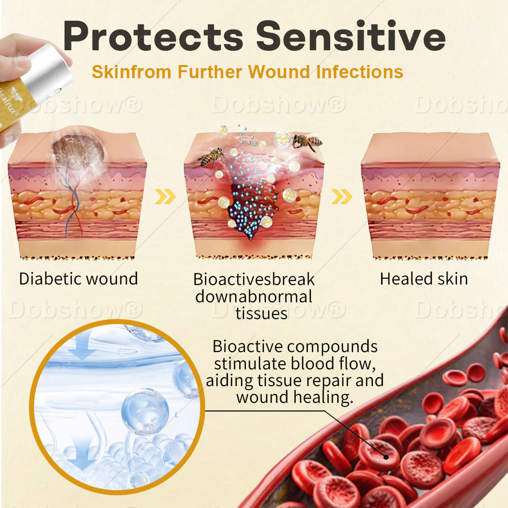 🔥𝙎𝙥𝙚𝙘𝙞𝙖𝙡 𝙋𝙧𝙤𝙢𝙤𝙩𝙞𝙤𝙣|  Healrize® GlucoShield Bee Venom Wound Spray🔥