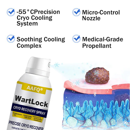 🖤🔥𝘽𝙡𝙖𝙘𝙠 𝙁𝙧𝙞𝙙𝙖𝙮 𝙨𝙖𝙡𝙚 | AAFQ® WartLock CRYO RECOVERY SPRAY