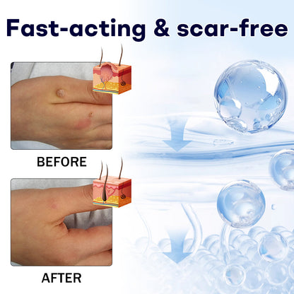 🖤🔥𝘽𝙡𝙖𝙘𝙠 𝙁𝙧𝙞𝙙𝙖𝙮 𝙨𝙖𝙡𝙚 | AAFQ® WartLock CRYO RECOVERY SPRAY