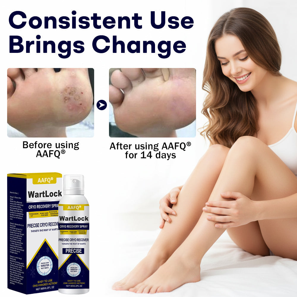 🖤🔥𝘽𝙡𝙖𝙘𝙠 𝙁𝙧𝙞𝙙𝙖𝙮 𝙨𝙖𝙡𝙚 | AAFQ® WartLock CRYO RECOVERY SPRAY