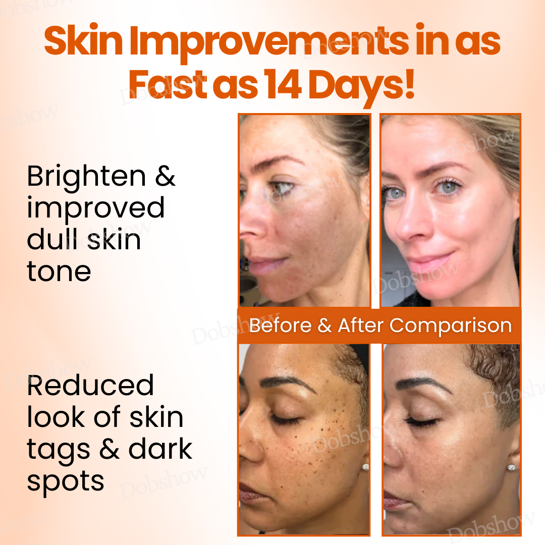 Dobshow™ SpotErase Trio Vitamin C 20% Removal Cream