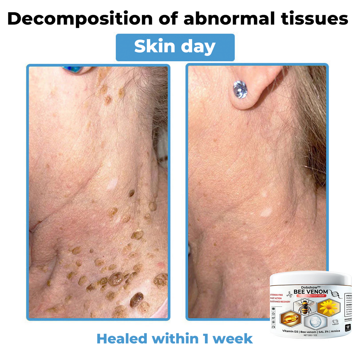 Dobshow™ 🐝Bee Venom Multisymptom Therapy Cream >> ✅65%OFF