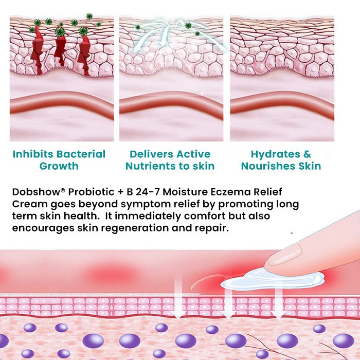 Dobshow® Probiotic + B 24-7 Moisture Eczema Relief Cream