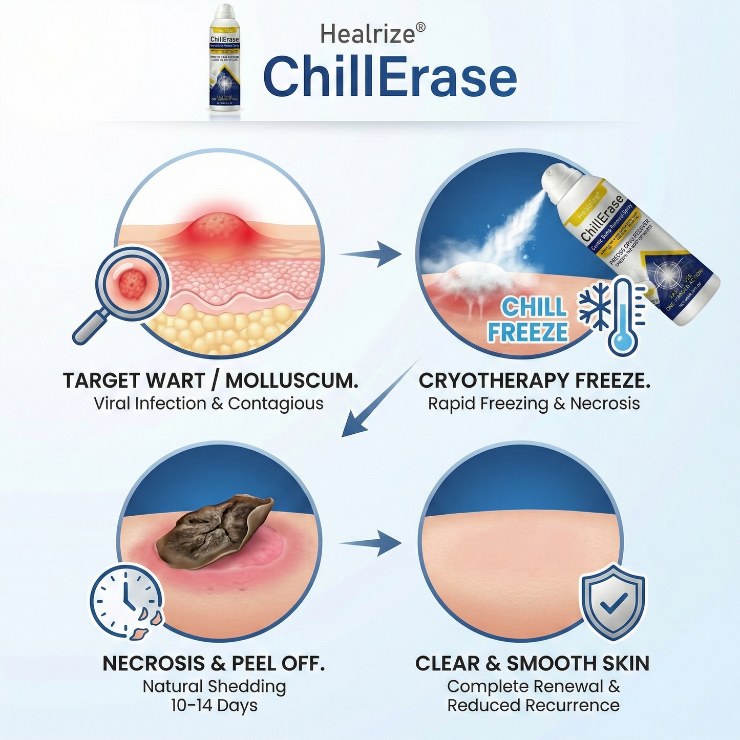 ❄️Healrize®ChillErase Gentle Bump Renewal Spray