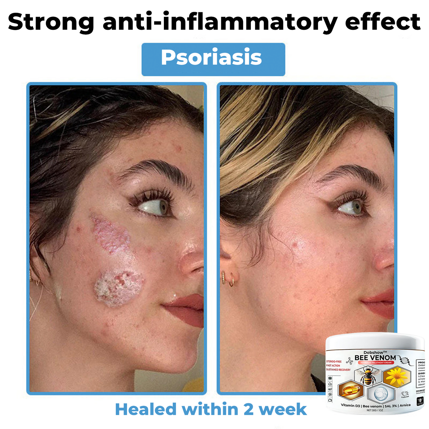 Dobshow™ 🐝Bee Venom Multisymptom Therapy Cream >> ✅65%OFF