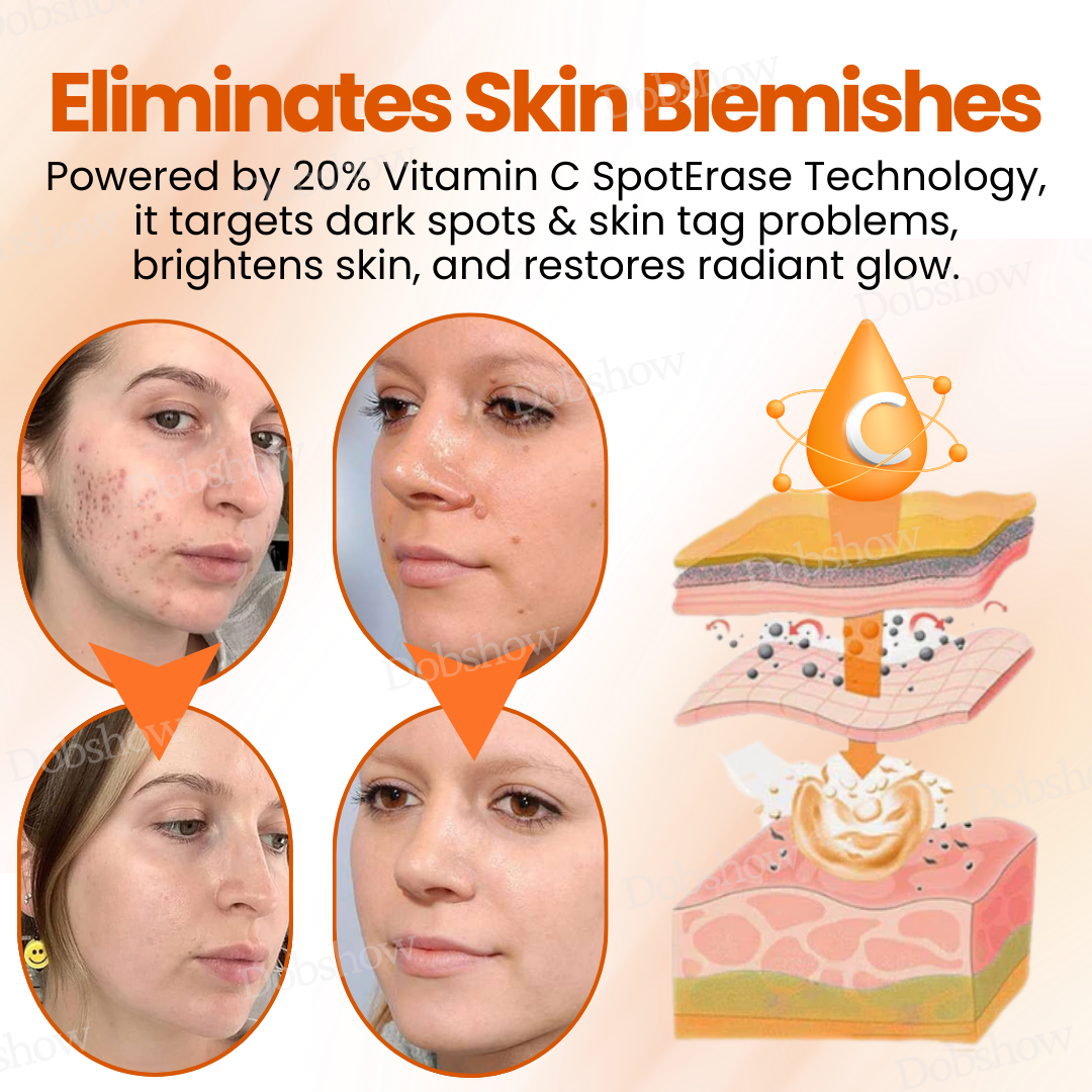 Dobshow™ SpotErase Trio Vitamin C 20% Removal Cream