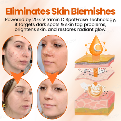 Dobshow™ SpotErase Trio Vitamin C 20% Removal Cream