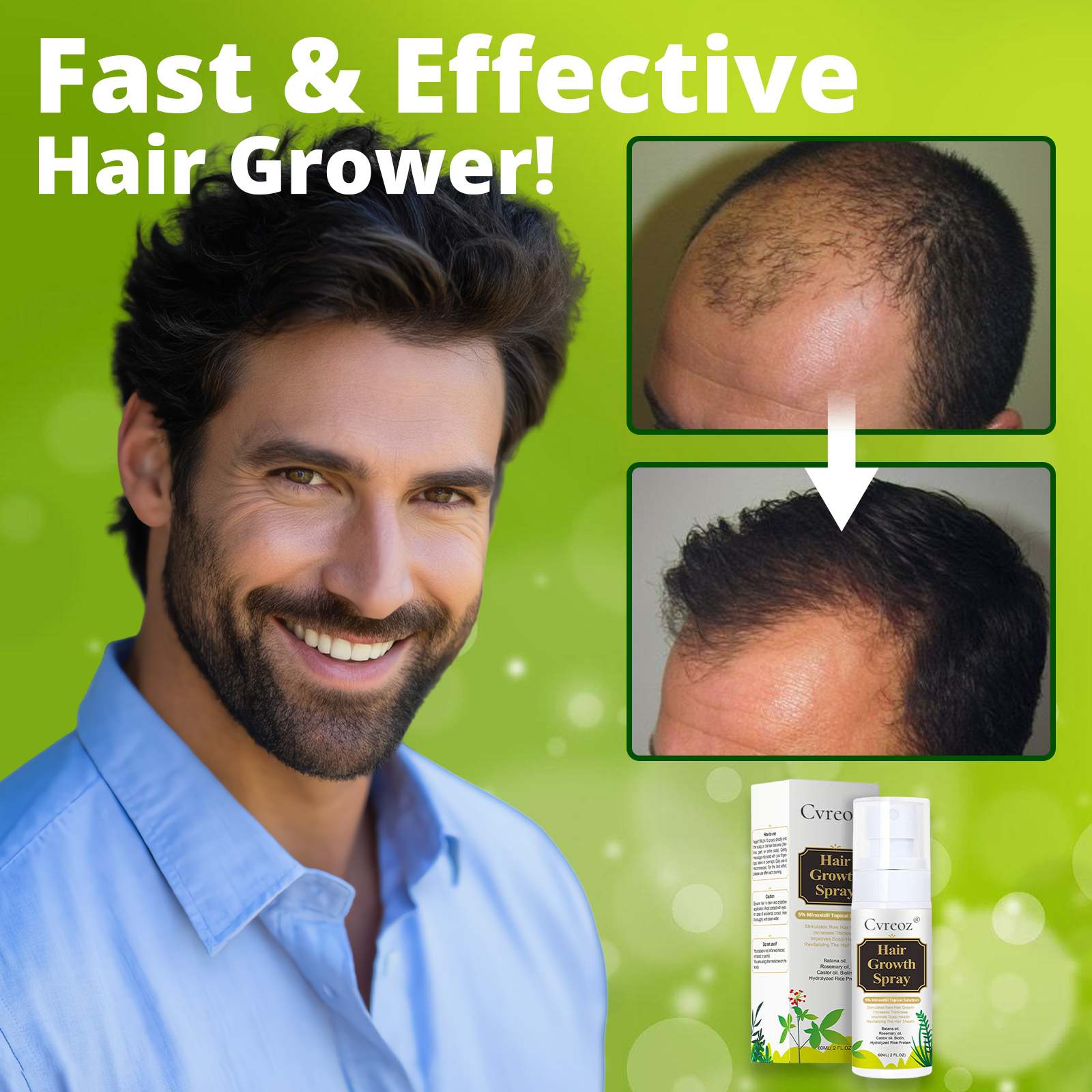 Cvreoz® Max-Strength Hair Regrowth Spray