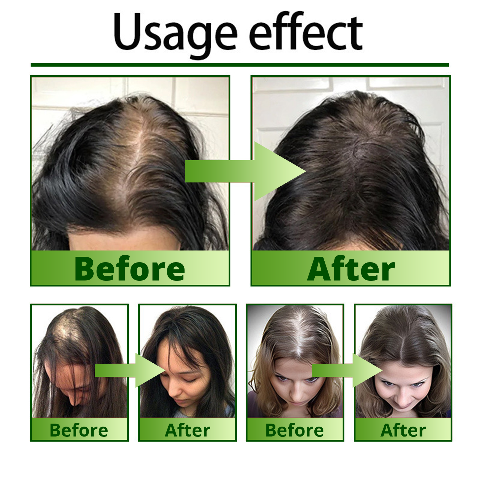 Cvreoz® Max-Strength Hair Regrowth Spray