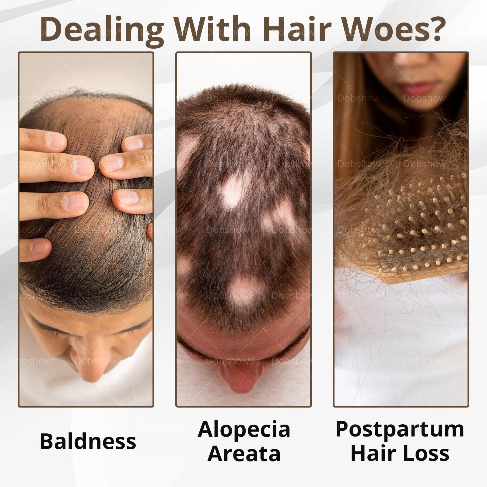 ⓒⓥⓡⓔⓞⓩ® 5% Minoxidil Hair Pro-growth Treatment
