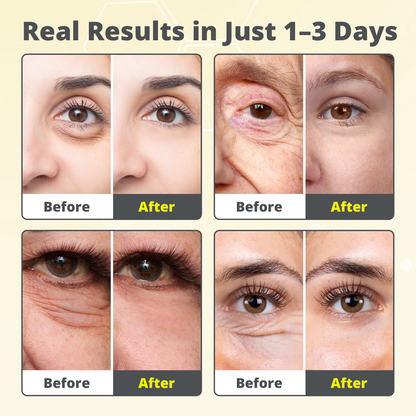 Dobshow® The 7-Day V-Line Shot: Vita A Retinal Tightening Serum