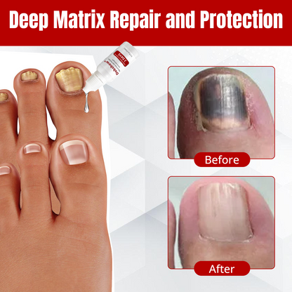 Dobshѳw® MycoClear Nail Renew Extra Strength